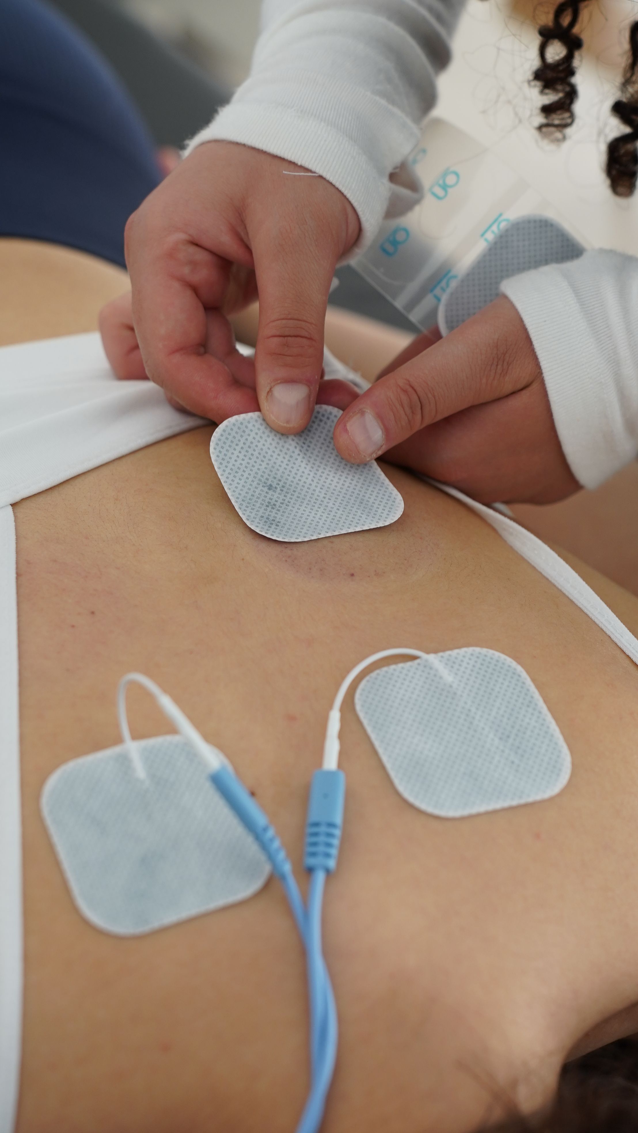 Therapist applying electrotherapy electrode pads to a patient’s back